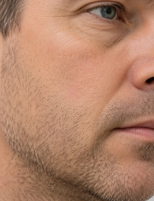 После